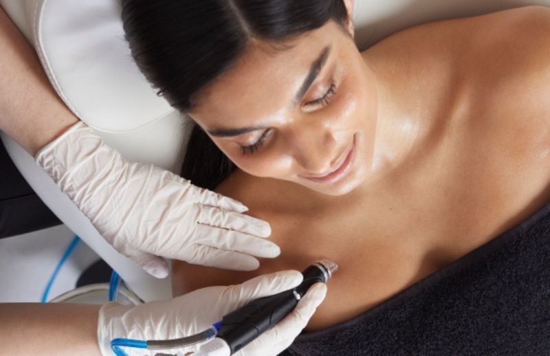 Décolleté Botox Treatment | Smooth Chest Wrinkles & Lines