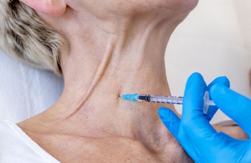 Nefertiti Neck Lift Botox | Jawline & Platysma Band Lift