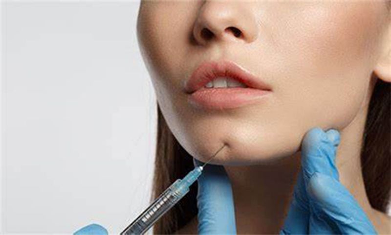 Hyaluronic Acid Chin Fillers | Weak Chin & Projection Enhancement