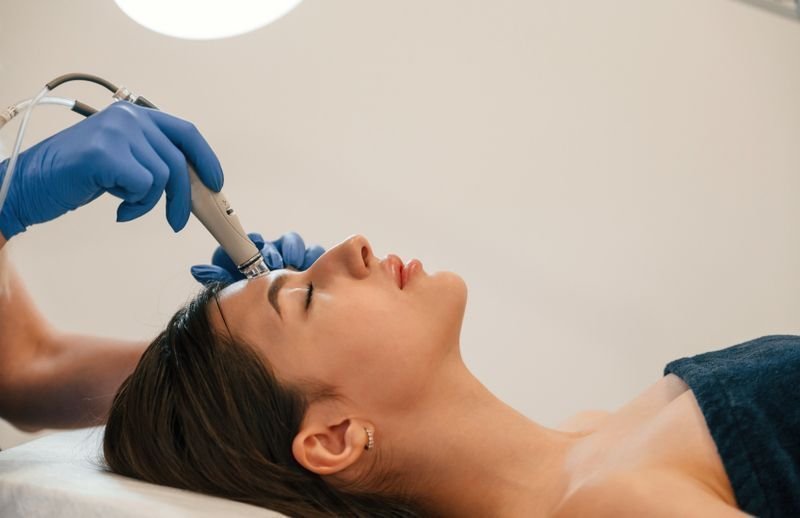 Microneedling London ON | Pinkal Medical Aesthetics