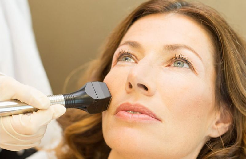 FORMA Skin Tightening Treatment London ON