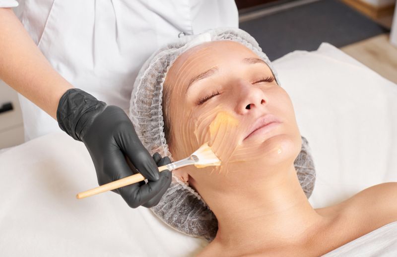 Chemical Peels London ON | Pinkal Medical Aesthetics