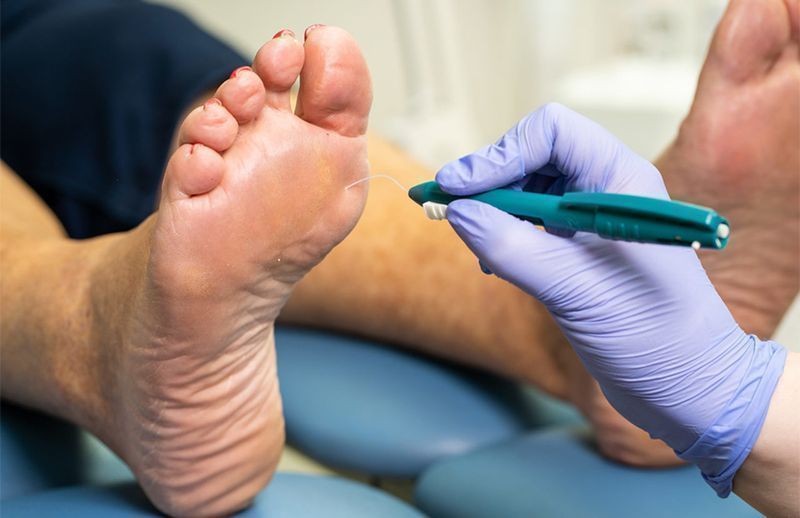 Medical Foot Care London ON | Pinkal Aesthetics Clinic