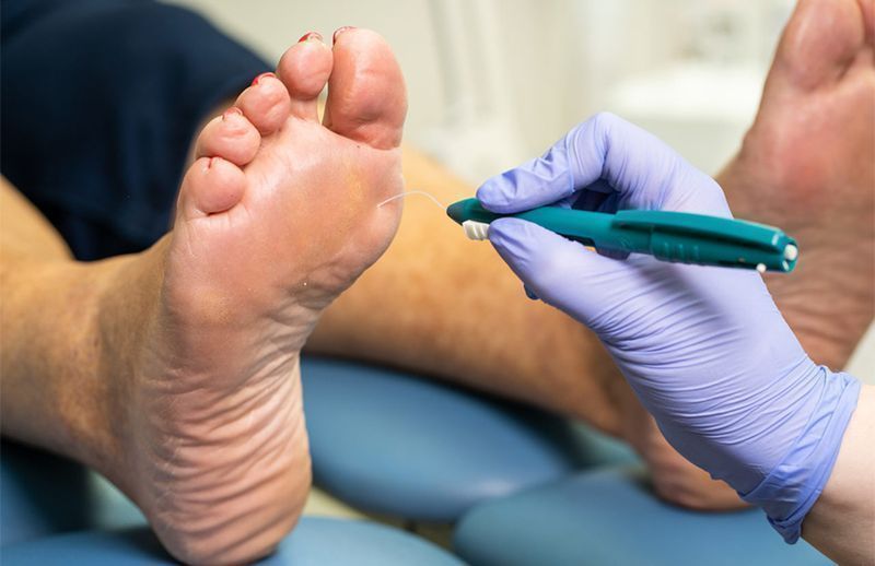 Diabetic Foot Care London ON | Pinkal Medical Aesthetics