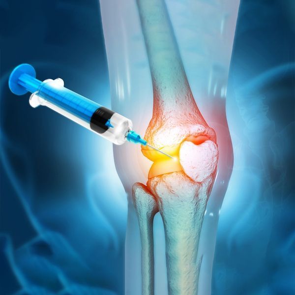 PRP for Knee Pain: A Revolutionary Treatment Option