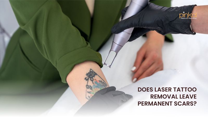 Does Laser Tattoo Removal Leave Permanent Scars? Honest Results Explained