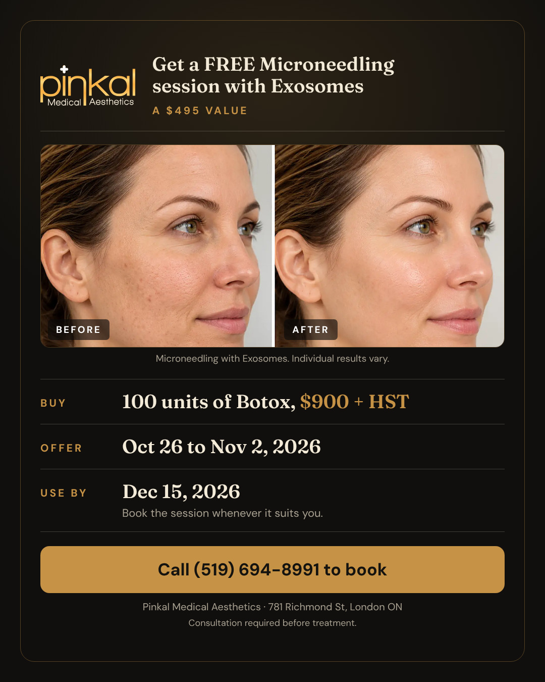 Get a FREE microneedling session with Exosomes ($495 value)